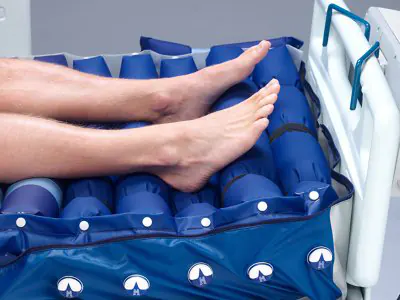 NIMBUS 4 Alternating Pressure Mattress